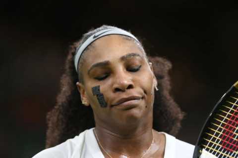 Why does Serena Williams wear plasters on her face when she plays?