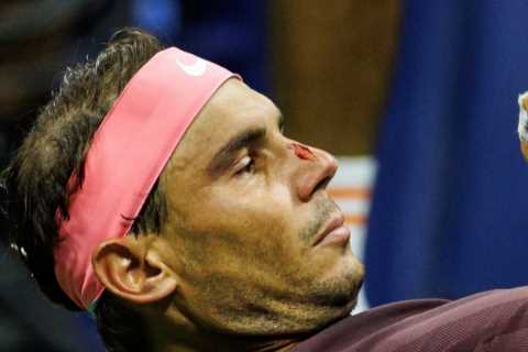 Watch Rafa Nadal whack his own face with tennis racket and leave himself bloodied and dazed on ground at US Open