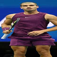 My Brother Butchered My Hair and Now I Look Like a Tennis Monk